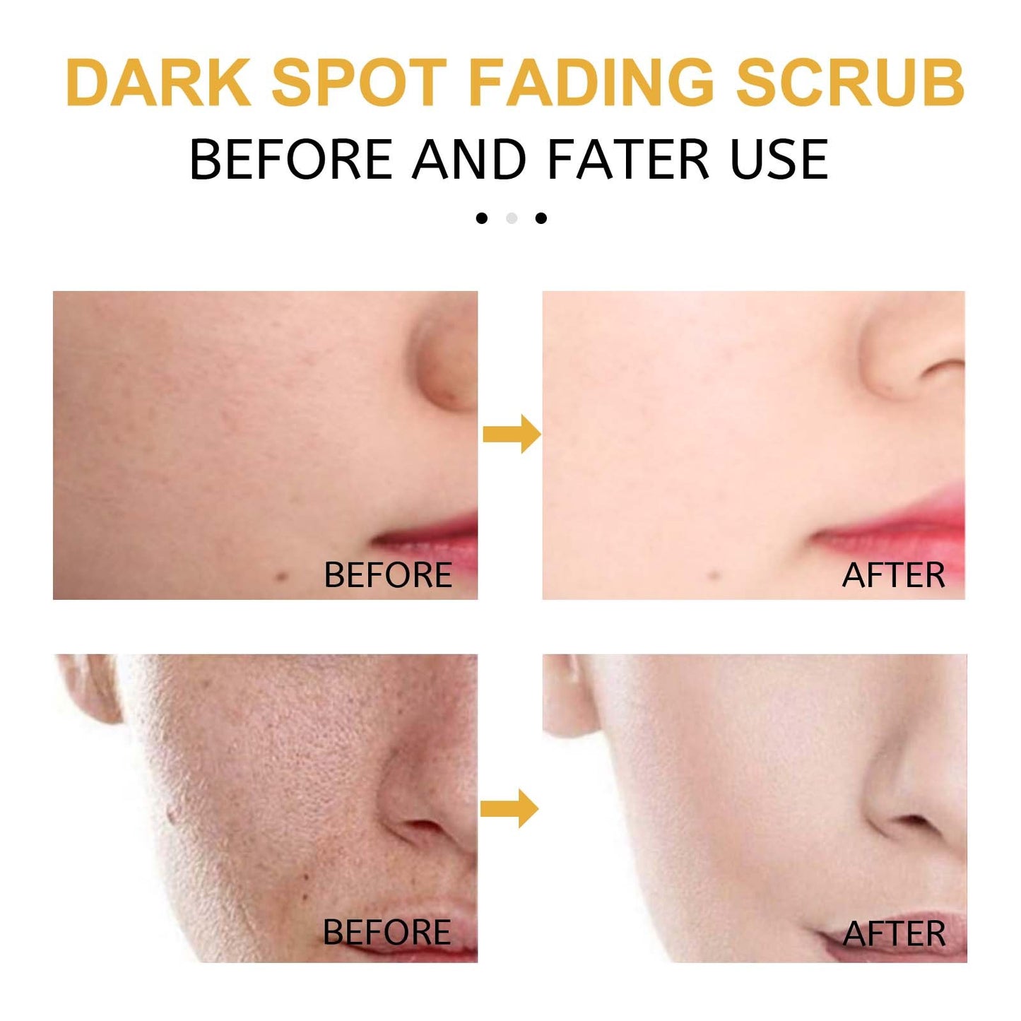 USA ONLY: Eelhoe Turmeric Exfoliating Facial Scrub For Deep Cleansing Of Delicate Pores And Beauty Cleansing Treatment