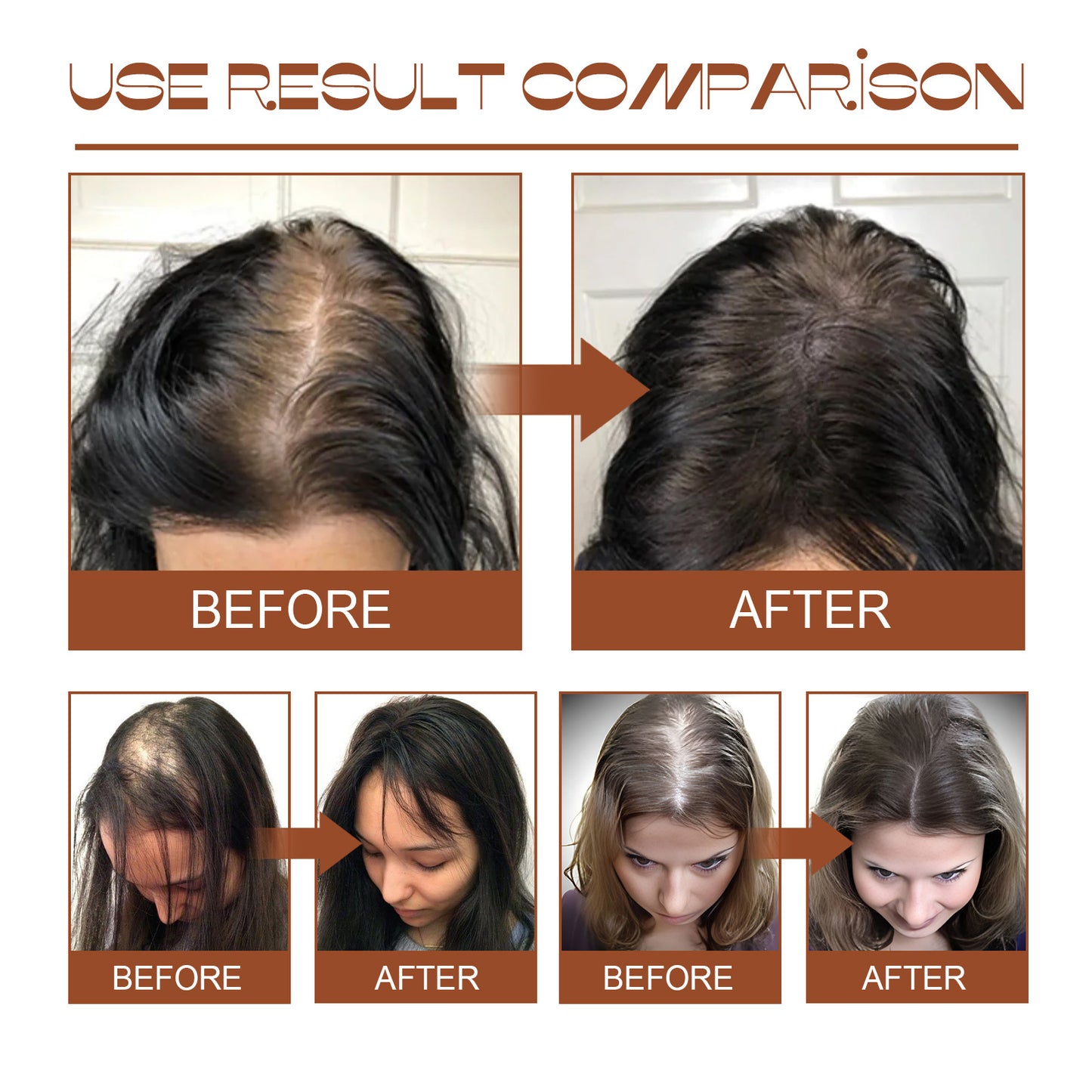 USA ONLY: EELHOE Batana Oil Conditioner Moisturizes, Repairs, Strengthens Hair Roots, Prevents Supple, Dense Hair, And Solidifies And Fluffy Hair