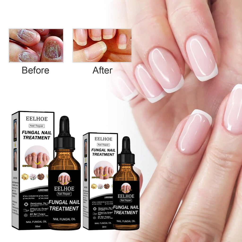 USA ONLY: EELHOE Nail Repair Solution, Thickening And Brightening Nails Removing Gray Nail Repair Nourishing Nail Care Solution