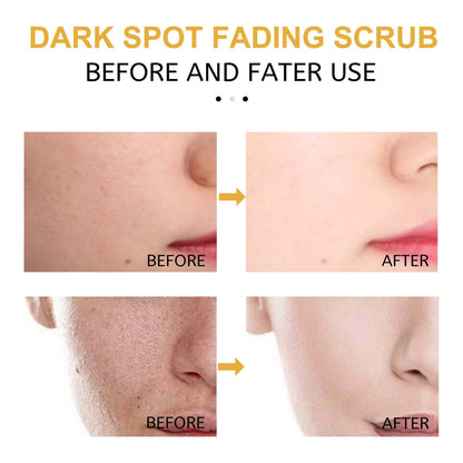 USA ONLY: Eelhoe Turmeric Exfoliating Facial Scrub For Deep Cleansing Of Delicate Pores And Beauty Cleansing Treatment